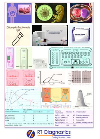 Chlamydia Trachomatis IgG | RT Diagnostics